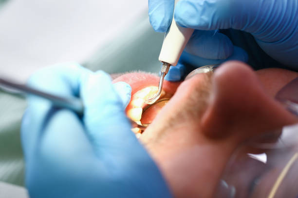 Best Emergency Treatment for Jaw Pain or Injury in Woodville, MS