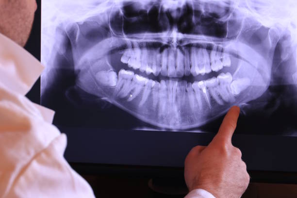 Best Walk-In Emergency Dental Services in Woodville, MS