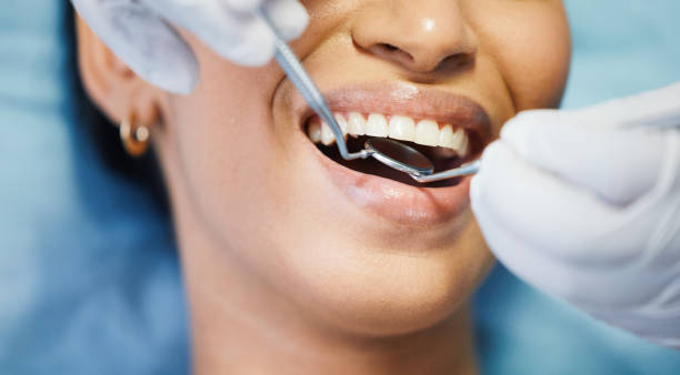 Best Broken or Chipped Tooth Repair in Woodville, MS